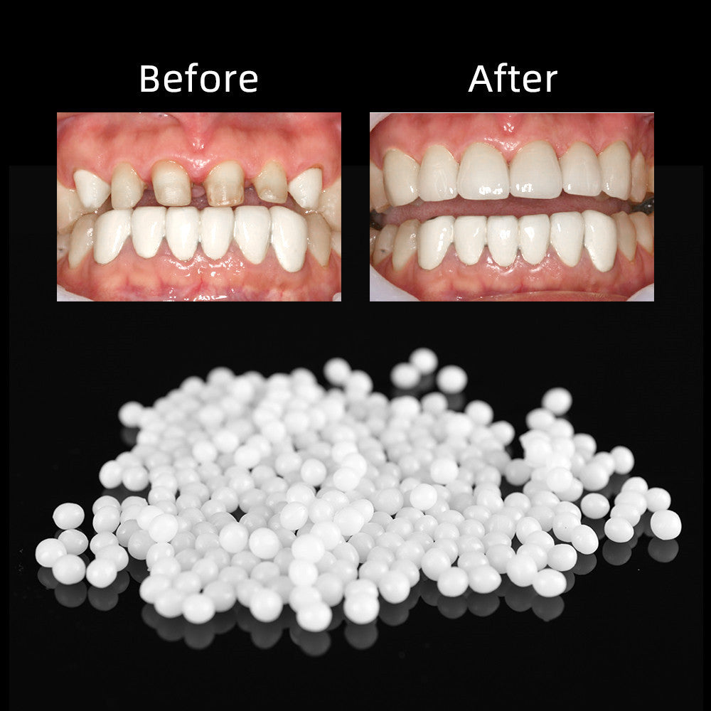 Reparación de dientes domésticos en bolsa, mordedor sólido soluble en caliente, reparación temporal de espacios entre dientes faltantes