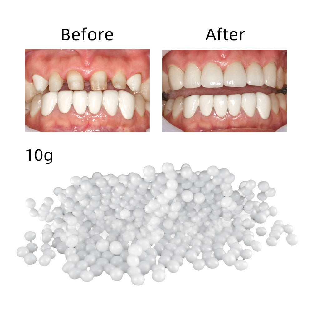 Reparación de dientes domésticos en bolsa, mordedor sólido soluble en caliente, reparación temporal de espacios entre dientes faltantes